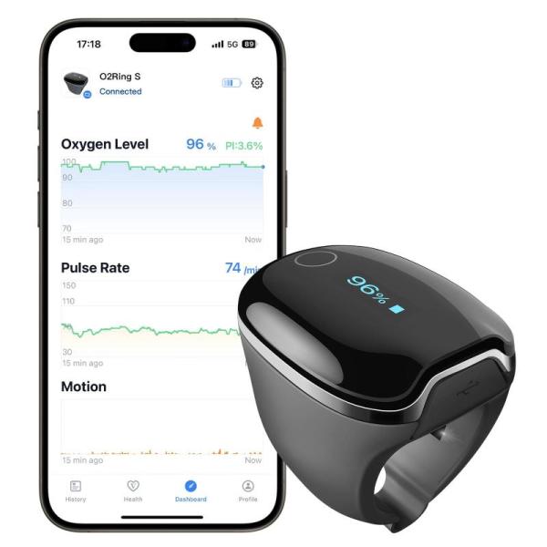 Sports - Wellue O2Ring-S Oxygen Monitor, VantagePro Carbon Fiber Pickleball Paddle - MSRP $9,562